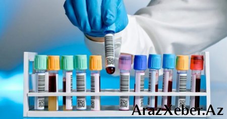 Azərbaycanda koronavirusla bağlı XƏBƏRDARLIQ 