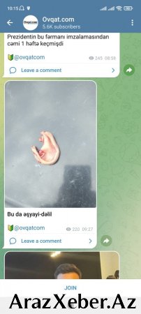 Azərbaycanda məmurun qulağını KƏSDİLƏR - FOTO