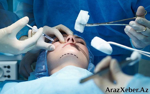 Plastik cərrahlara yanvarın 31-dək vaxt verildi –Rəsmi