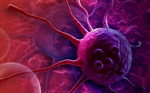 Xərçəng niyə artır? — Onkoloq gizli məqamları açıqladı
